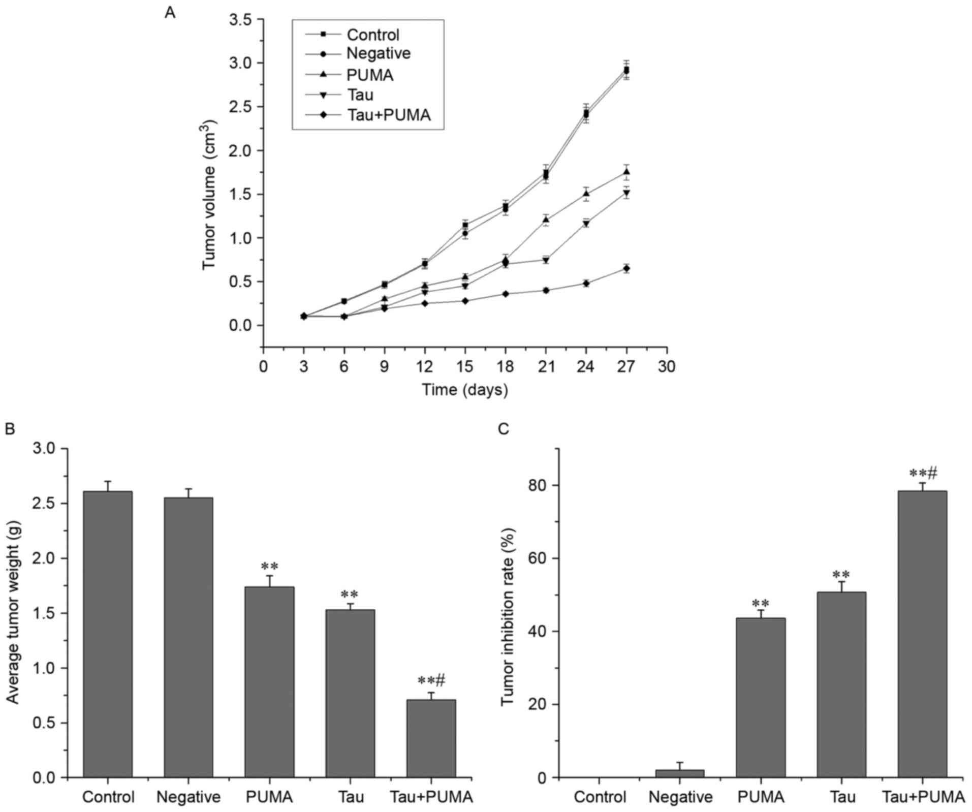 Effect of taurine on cell proliferation and apoptosis human lung cancer - Study Reveals Taurine’s Role In Tumors Fuelling Leukaemia Growth