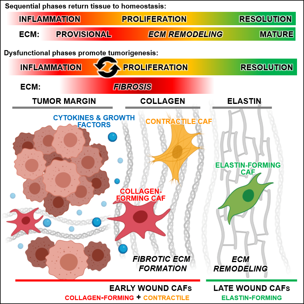 New Study Identifies Cancer-Associated Fibroblast Subtypes Based on - Cancer Rates In China Vs Us