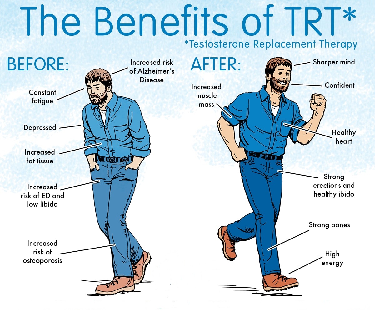 Trt Before And After 1 Year
