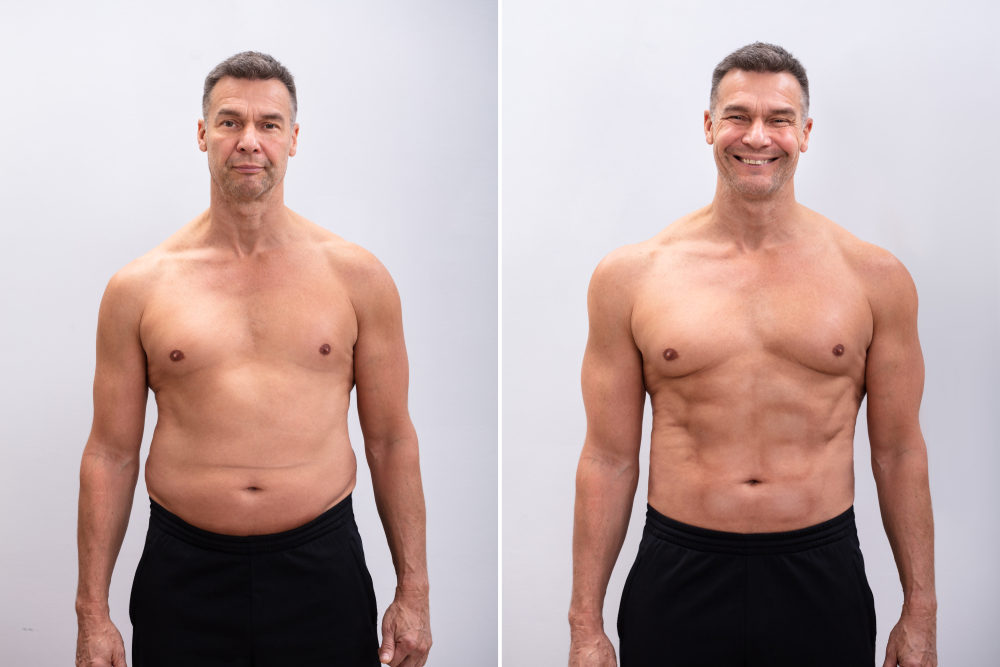 TRT Therapy - NRG Clinic: Leading in Hormone Therapy - Trt Before And After 1 Year