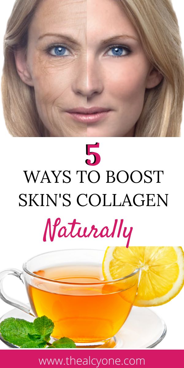 5 Ways To Preserve And Boost Collagen Production - The Alcyone - Does Taking Collagen Increase Scar Tissue