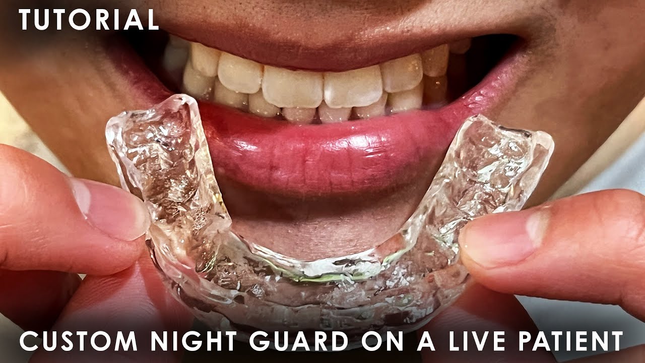 A Tutorial on how to Make a Custom Night Guard on a Live Patient - YouTube - How Much Is A Custom Night Guard