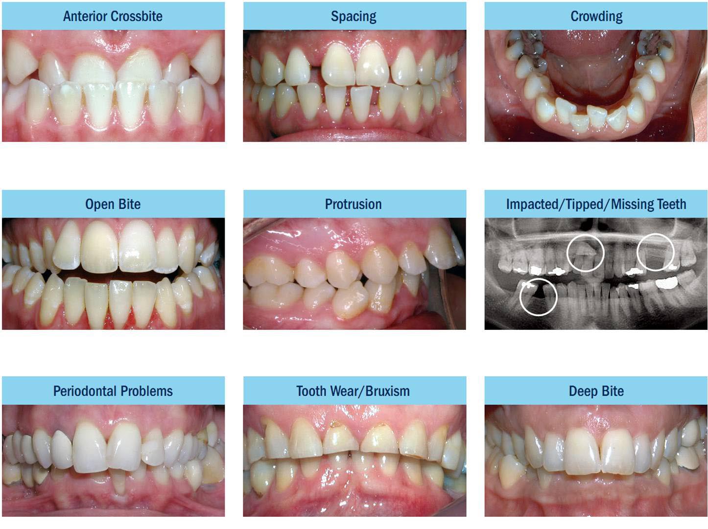 Adult Orthodontics | Guelph Orthodontics - Dr. Fiore - Individuals In What Age Group Seek Orthodontic Care