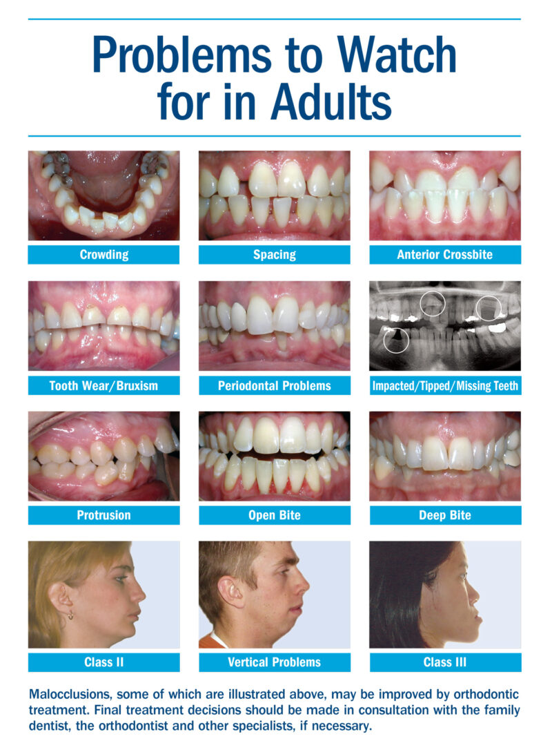 Adult Treatment - Haug Orthodontics | Alton, IL | Highland, IL - Individuals In What Age Group Seek Orthodontic Care