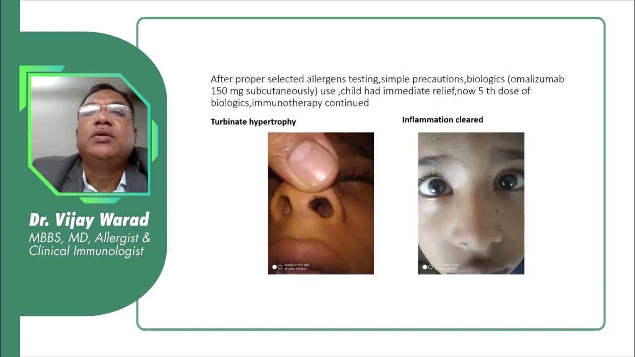 Advances in Asthma, Allergy Management - YouTube - Advancements In Allergy & Asthma Care Ltd