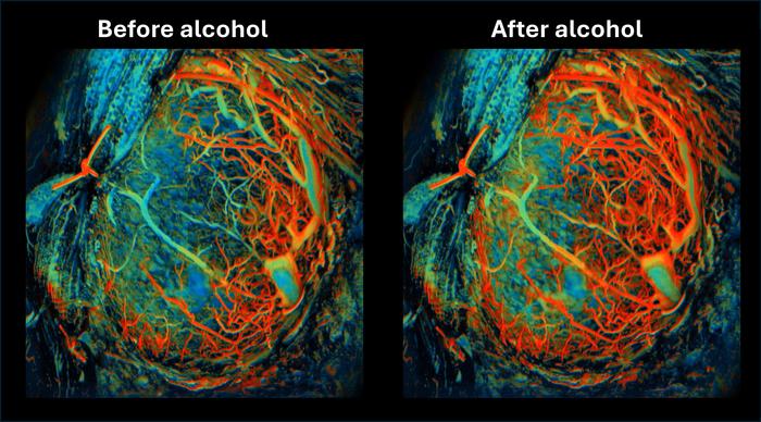 Alcohol consumption [IMAGE] | EurekAlert! Science News Releases - Affect The Amount And Rate The Alcohol Reaches The Bloodstream
