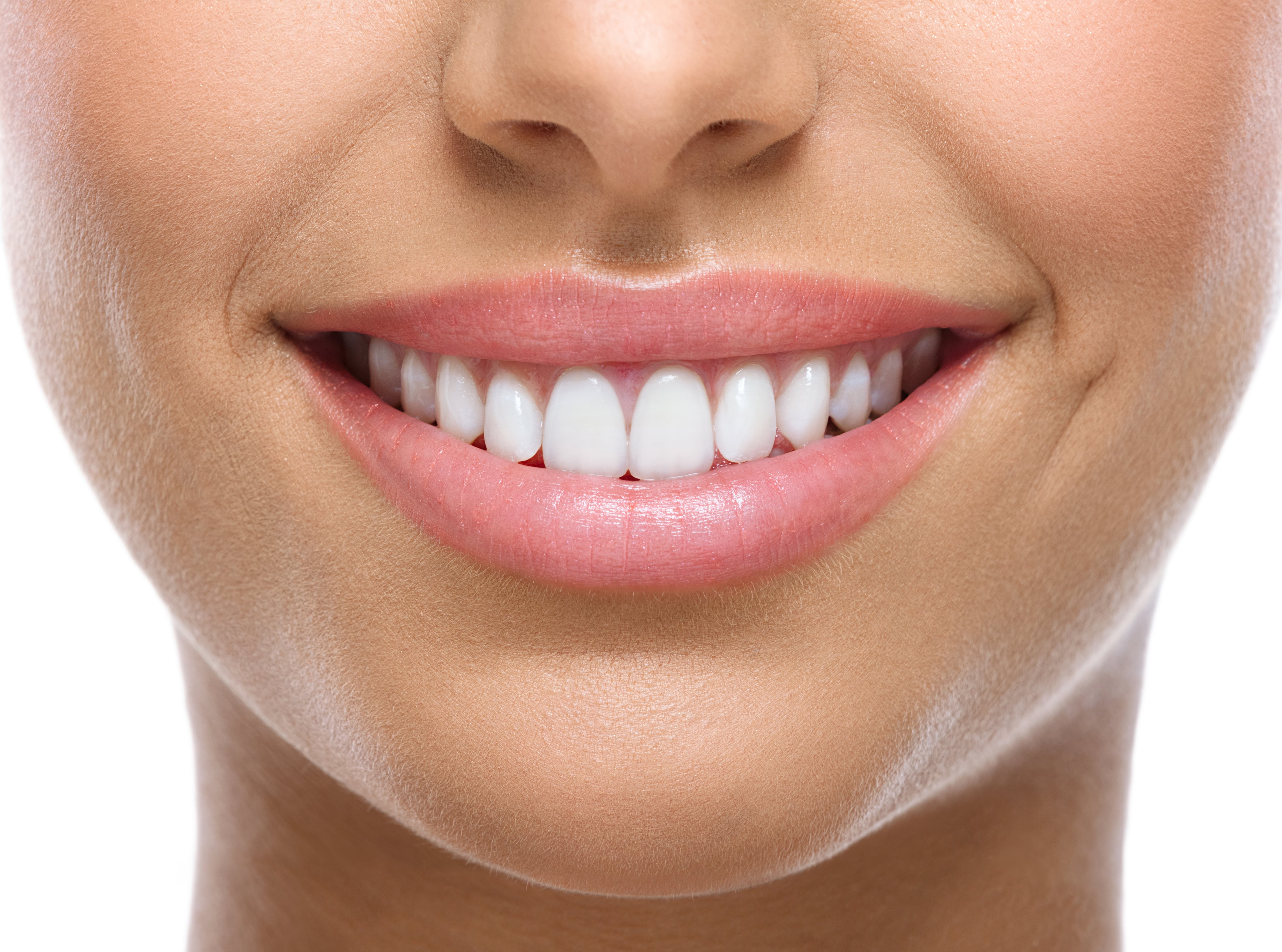 Smile Direct Club Bright On Premium Teeth Whitening Kit