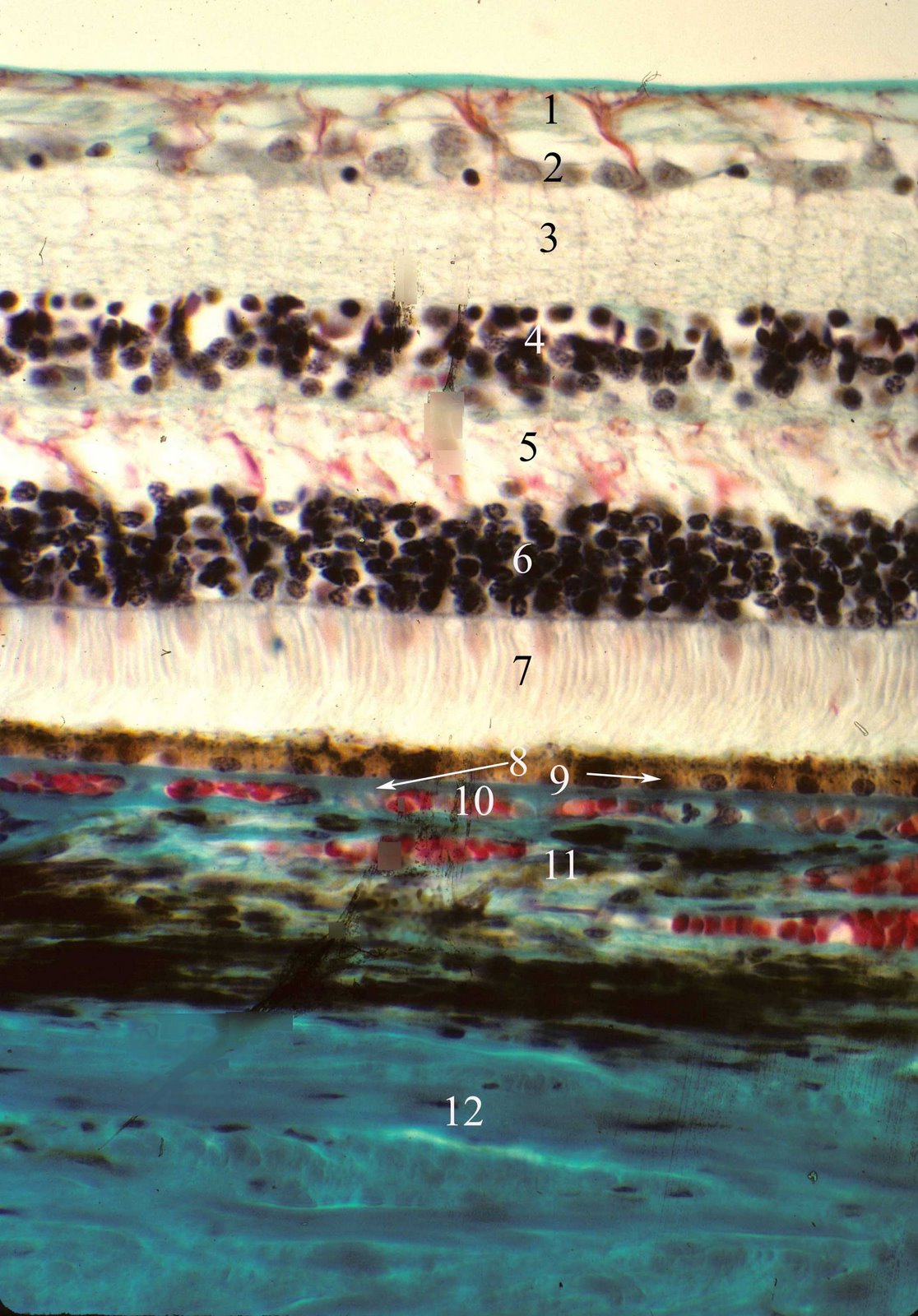 ANATOMY OF THE HUMAN EYE: Retina - Area Of Retina Specialized For Detailed Vision
