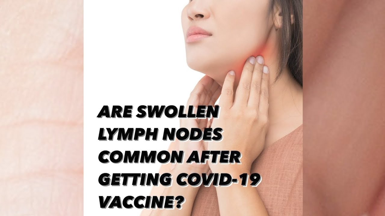 Are swollen lymph nodes common after getting COVID-19 vaccine? - YouTube - Swollen Lymph Nodes 12 Months After Covid Vaccine