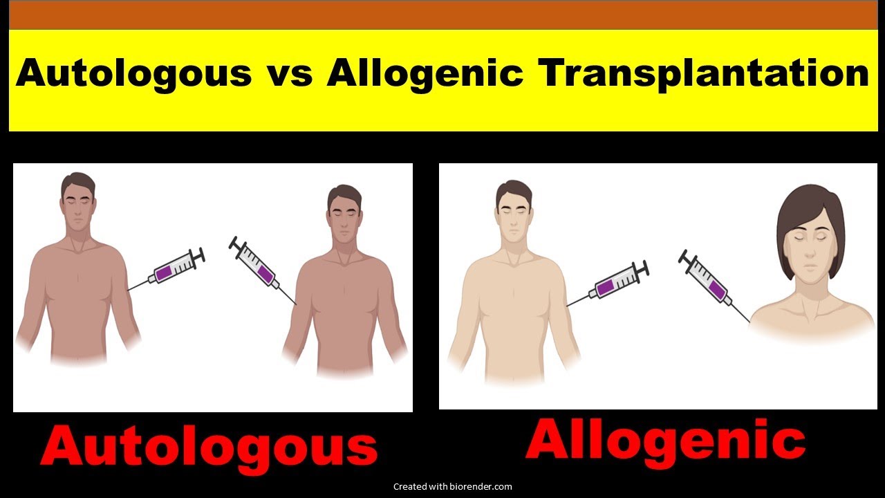 Autologous vs Allogeneic Transplant | Autologous and Allogeneic Stem - Autologous Vs Allogeneic Stem Cell Transplant