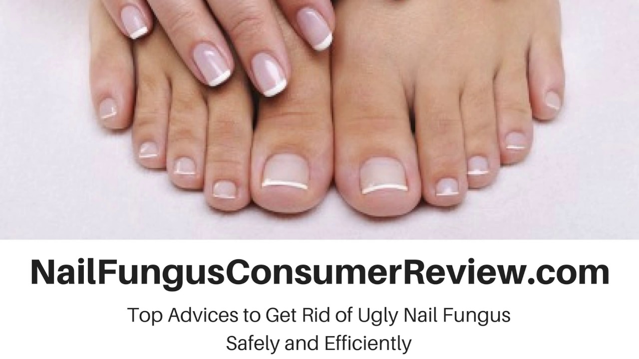 Best Toenail Fungus Treatment Reviews - Don't Be Confused Anymore - Fungus Exodus For Toenail Fungus Reviews Consumer Reports