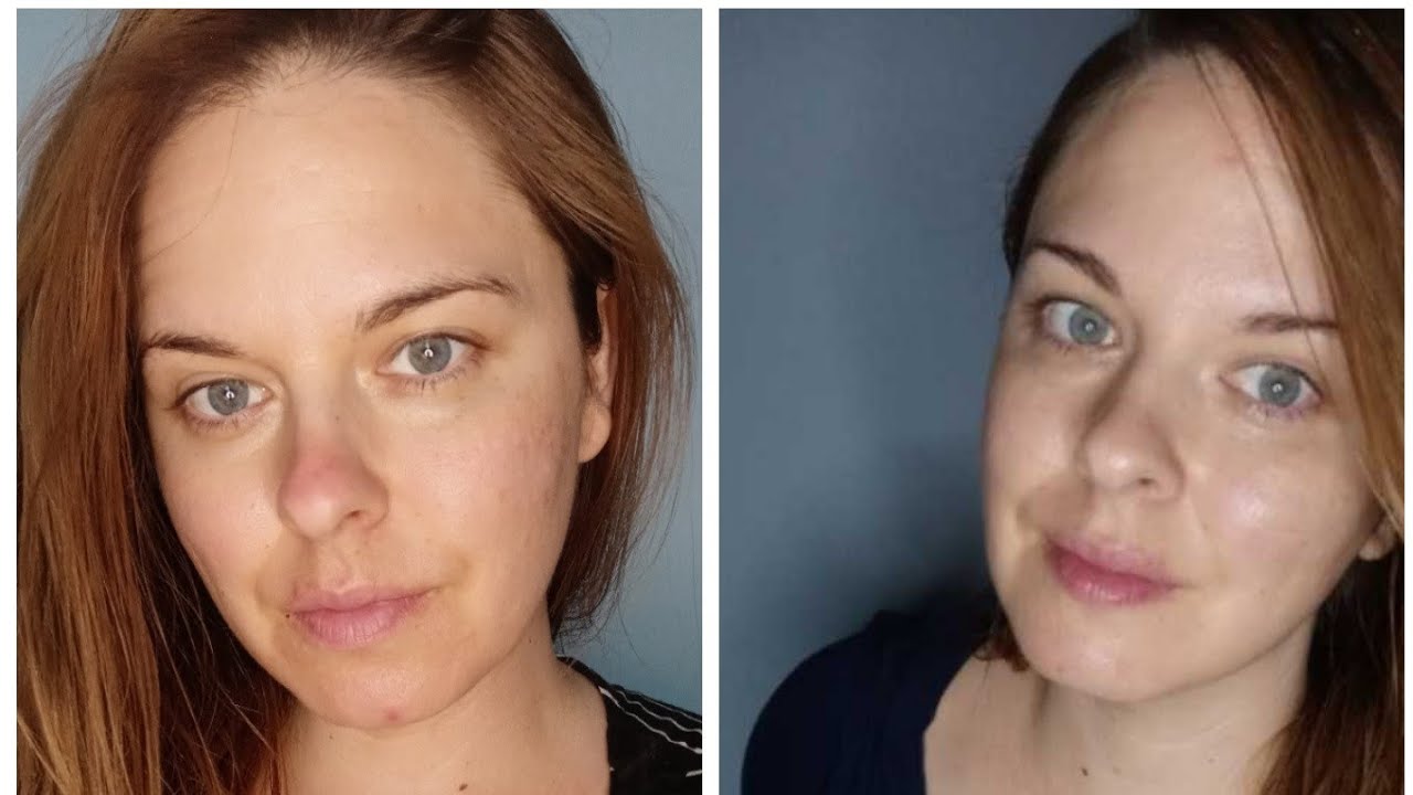 Reviews On Beverly Hills Md Dermal Repair Complex