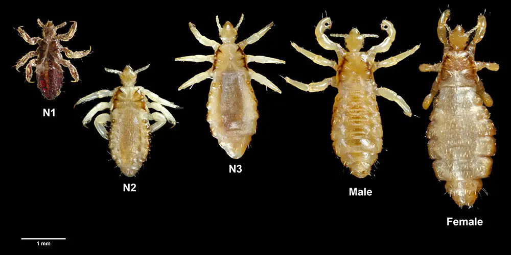 Body Lice | symptoms, diagnosis, treatment, pictures, home remedies - Lice Clinics Of America - Dublin & Columbus