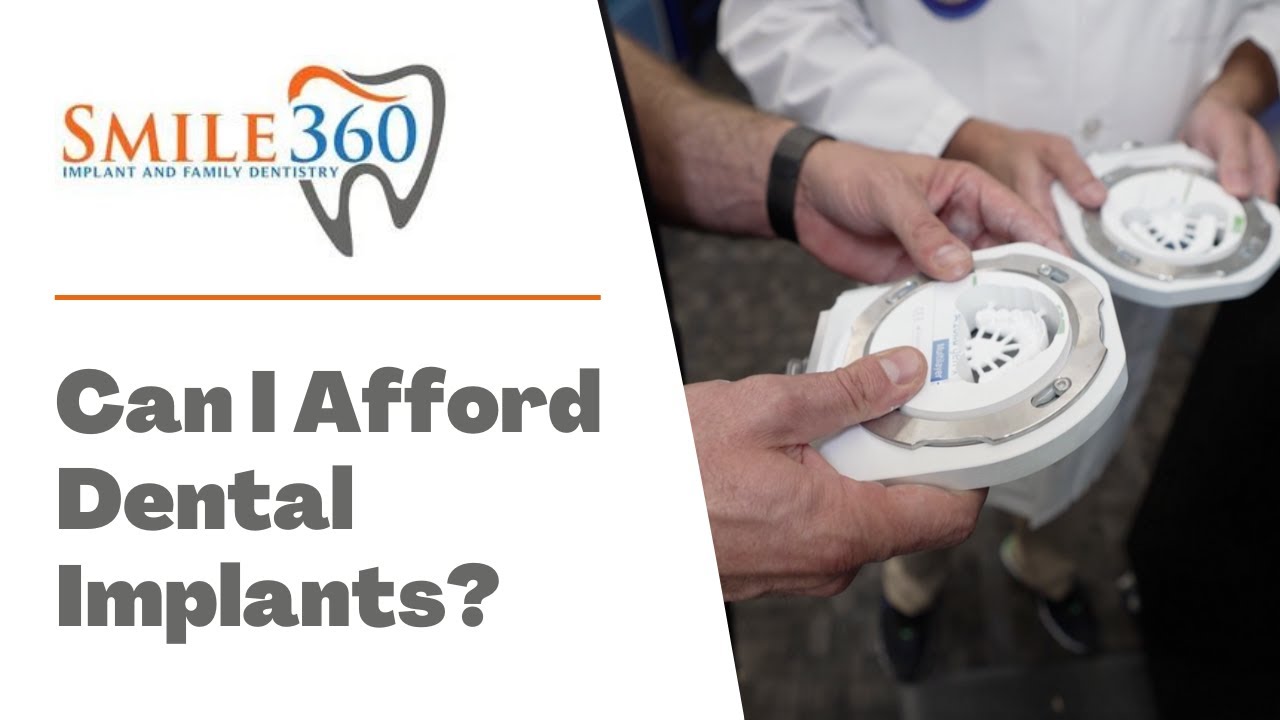 How Much Does Aflac Pay For Dental Implants