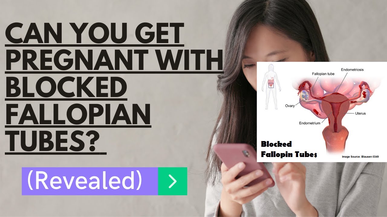 Miracle Pregnancy With Blocked Fallopian Tubes