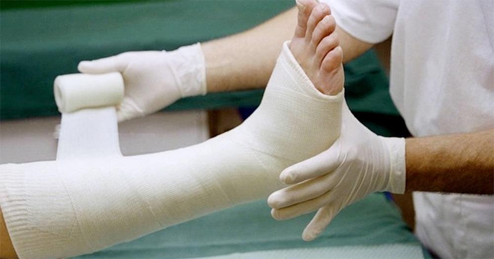 Cast Care - Dos and Don’ts of Taking Care of Casts | Women’s Choice Award - Cast Of The Queen's Jewels Film