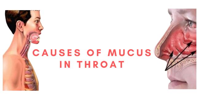 Cause Of Excess Mucus In Throat
