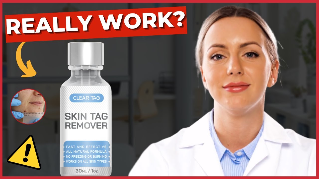 Allura Skin Tag Remover Reviews Consumer Reports