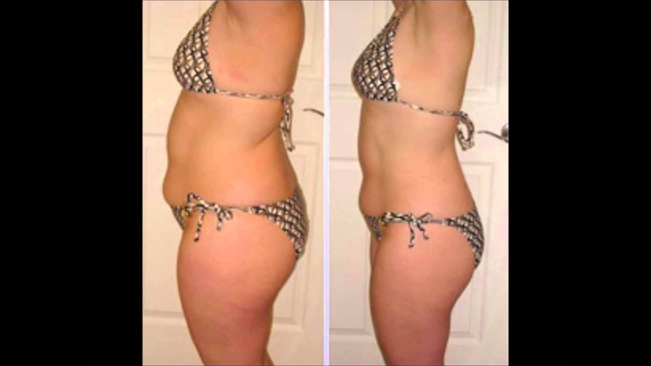 Colon Cleanse weight loss: Before & After - YouTube - Do Colonics Help With Weight Loss