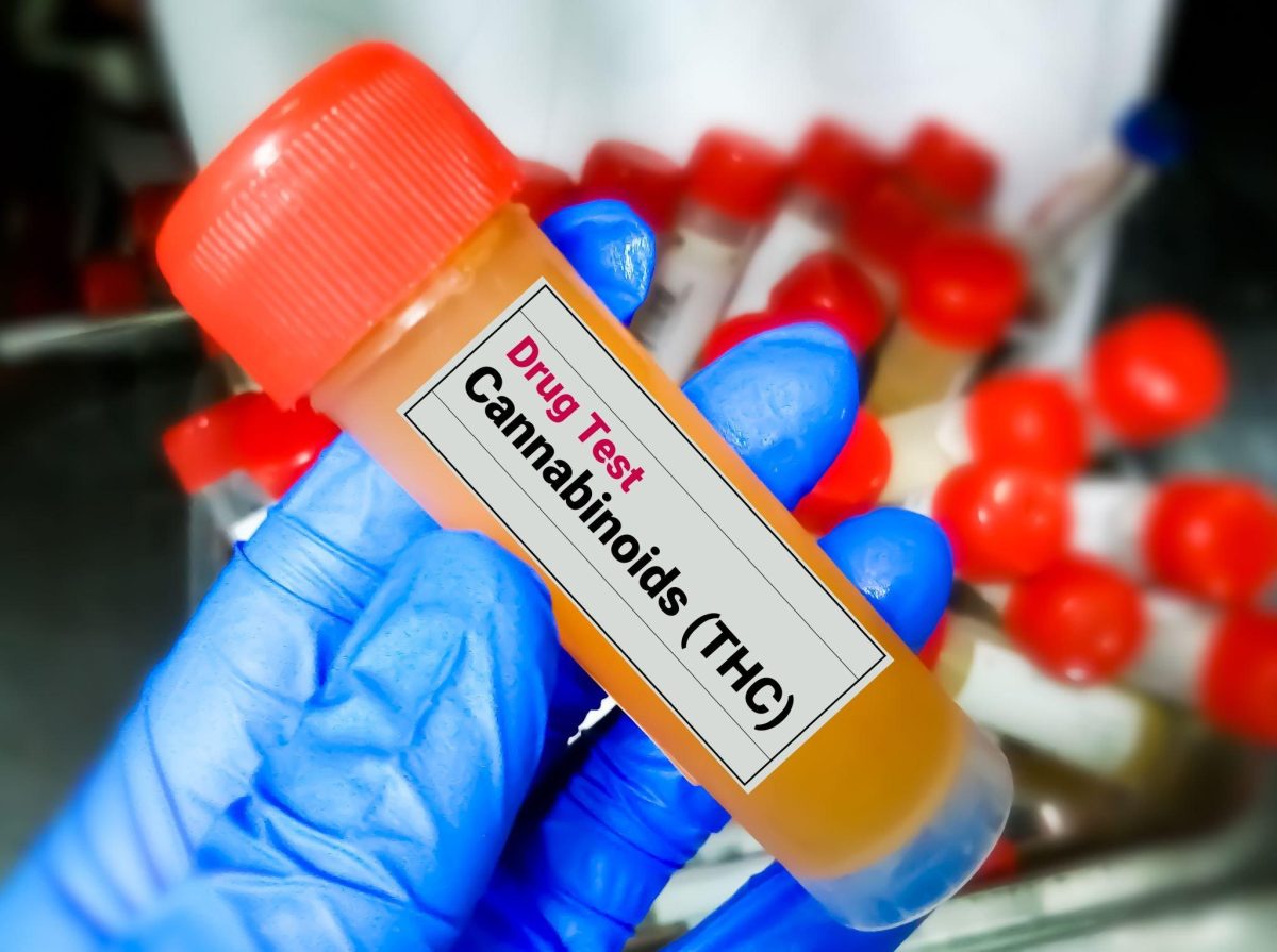 Delta 8 - Will Delta 8 Show Up On Drug Test