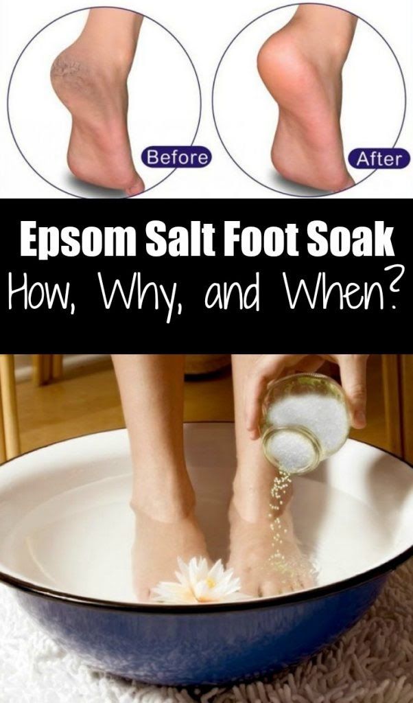 Epsom Salt Foot Soak: How, Why, and When? - Ritely | Epsom salt foot - Soaking Feet In Epsom Salt For Toenail Fungus