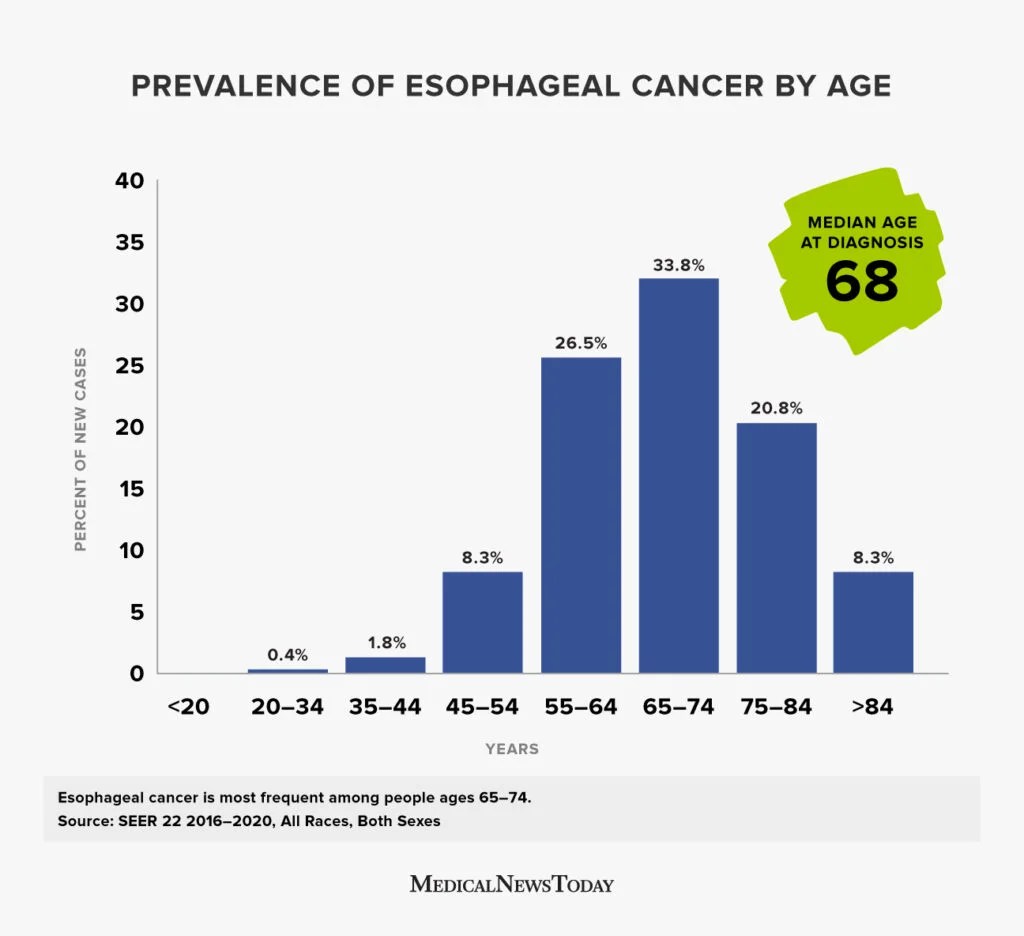 Stage 4 Esophageal Cancer Survival Rate By Age