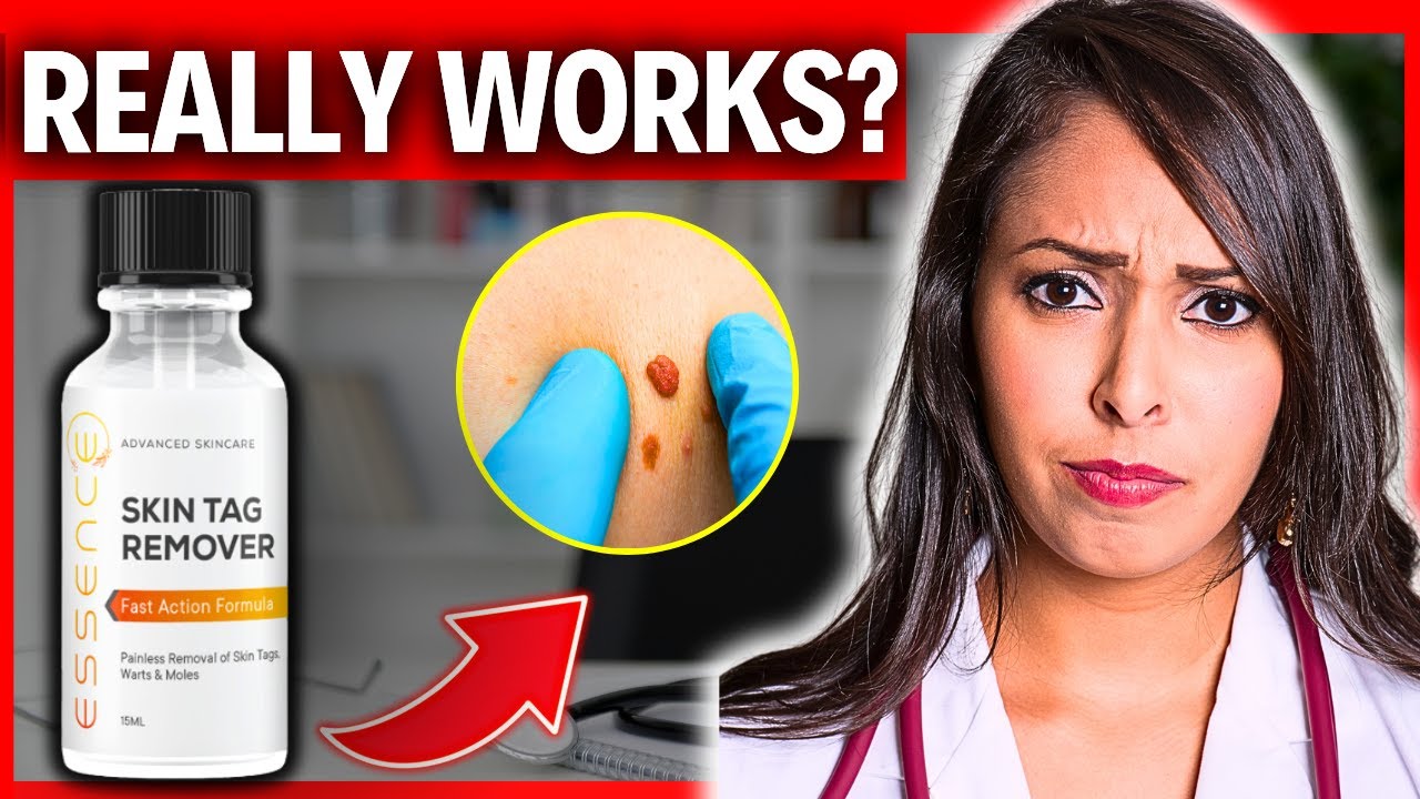 🔥 Essence Skin Tag Remover Reviews: Does It Work? Watch This Essence - Essential Oil To Remove Skin Tag