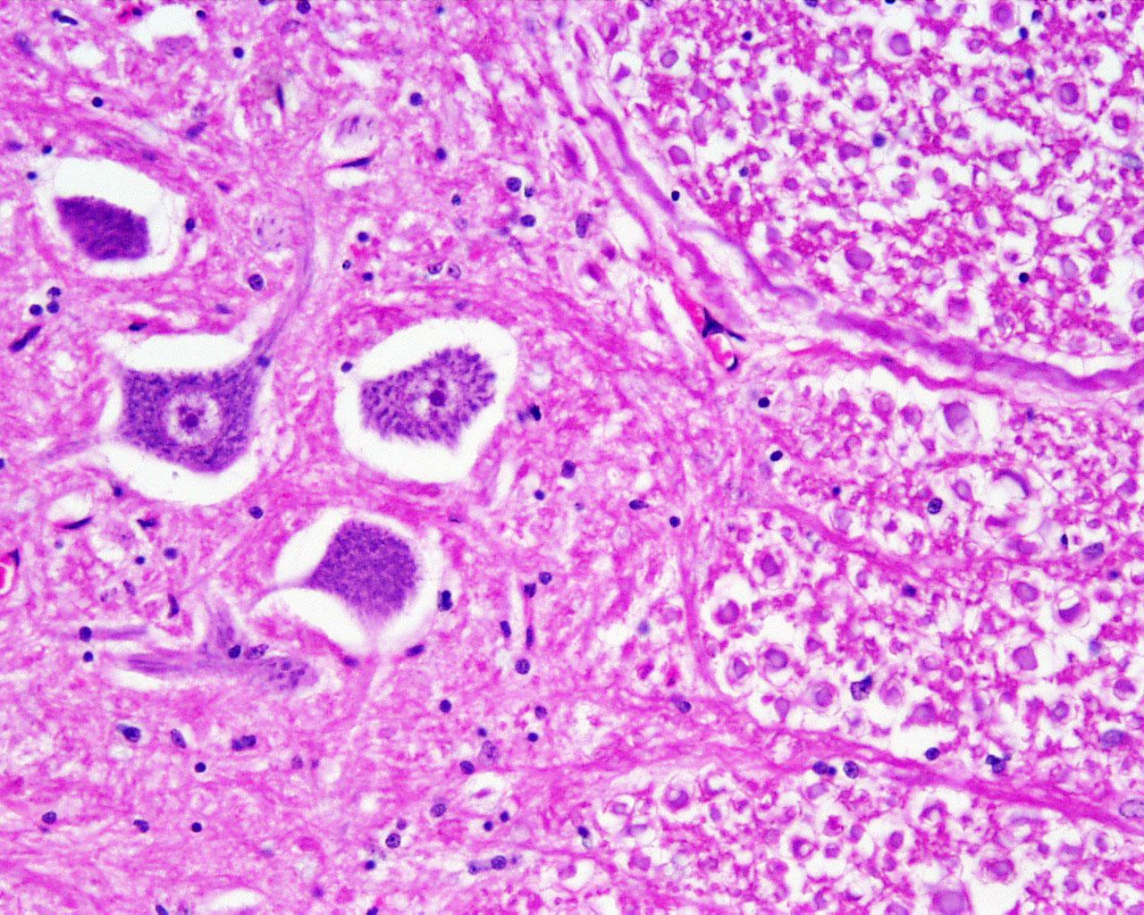 Histology And Cytology Medical Devices Pipeline Product Analysis