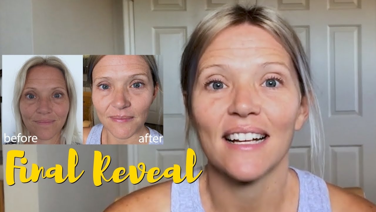 Final Reveal! Beverly Hills MD Dermal Repair Complex - YouTube - Reviews On Beverly Hills Md Dermal Repair Complex