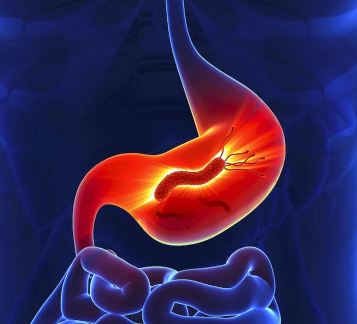 Gastritis: qué es, cómo son sus sintomas y su tratamiento - Natursan - Can Gastritis Cause High White Blood Count