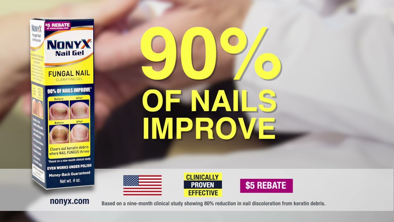 Get rid of Nail Fungus with Nonyx Fungal Nail Clarifying Gel. - YouTube - Nonyx Nail Gel Before And After