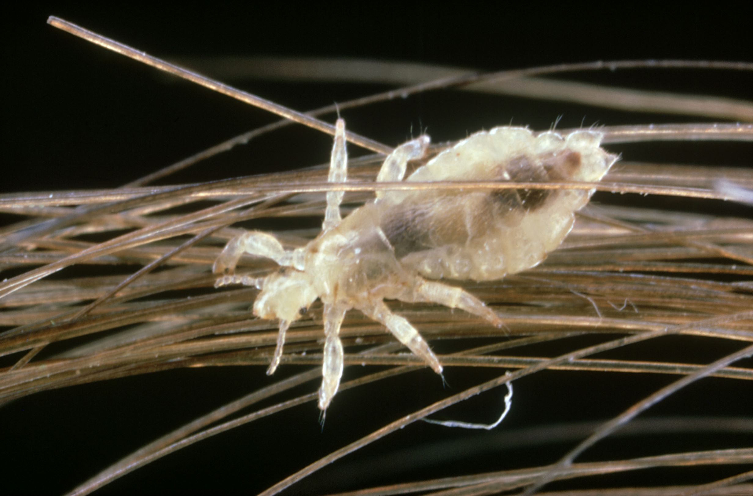 Lice Clinics Of America - Dublin & Columbus