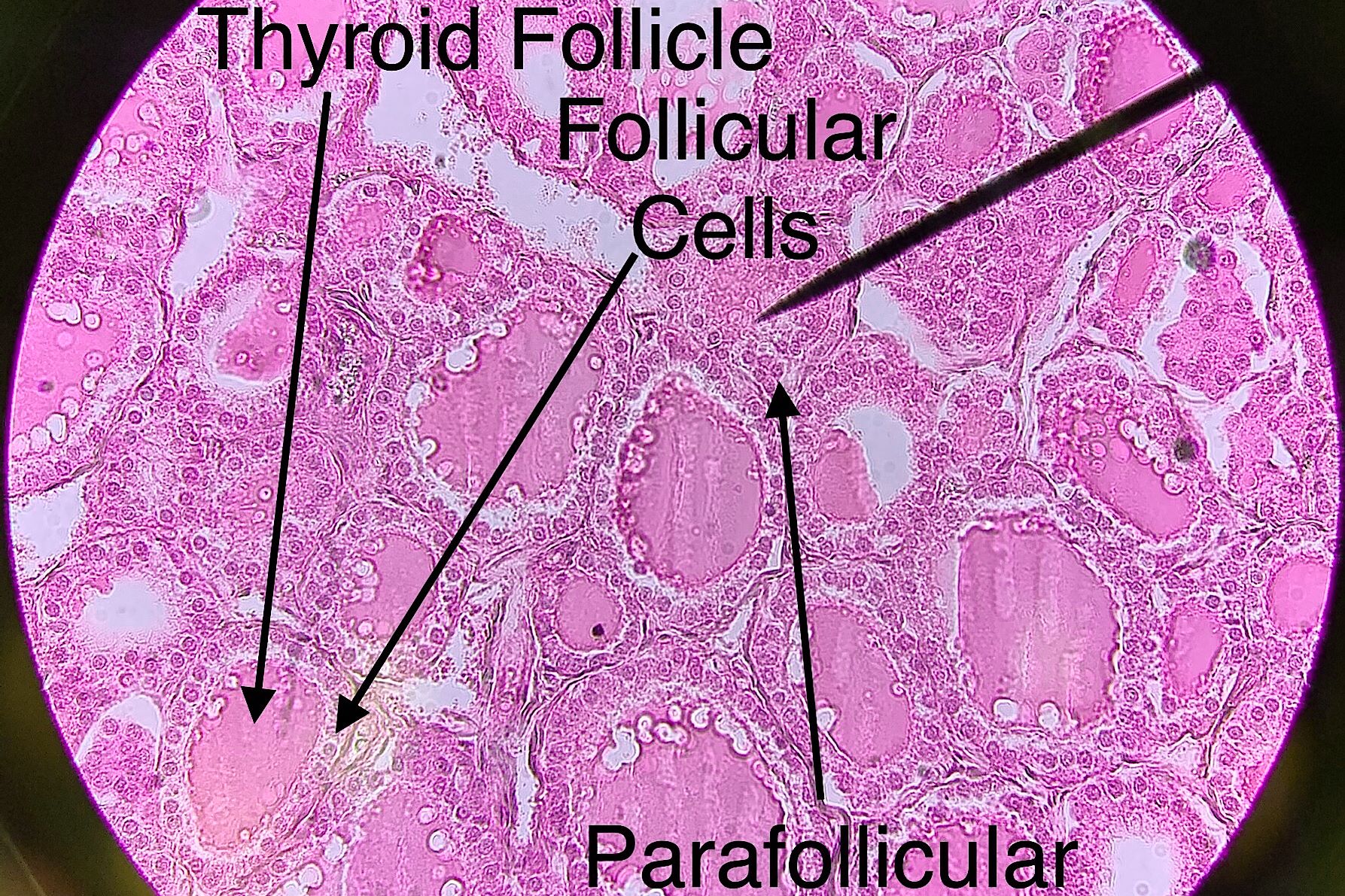 Histology Diagram Of Parathyroid Gland - Histology And Cytology Medical Devices Pipeline Product Analysis