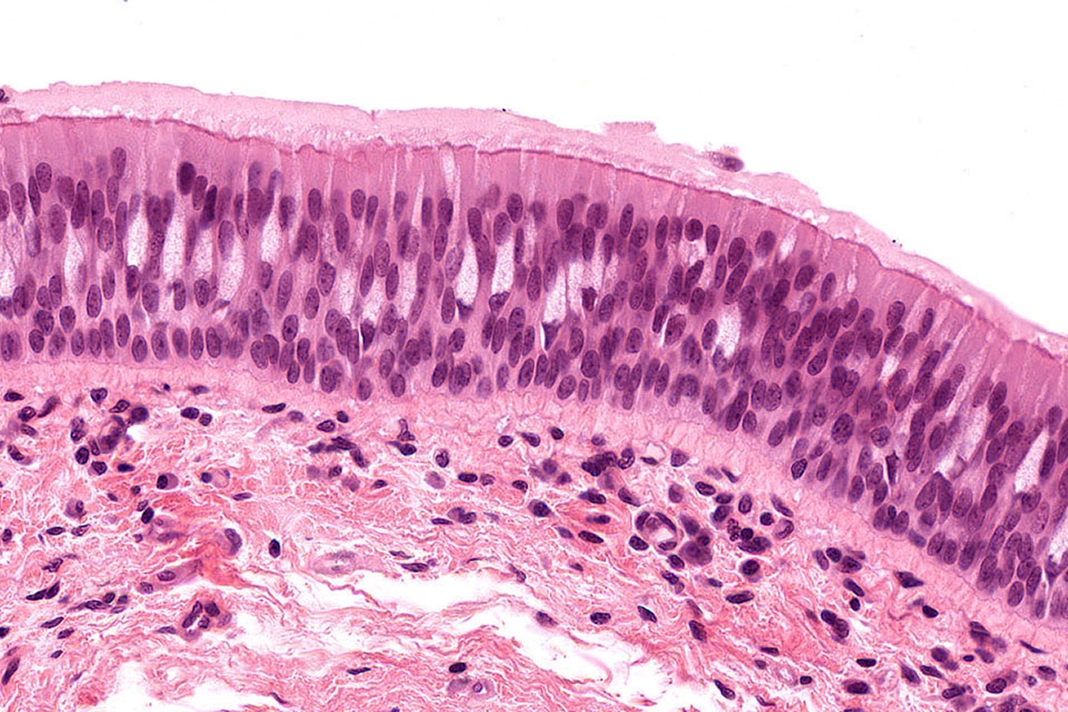 Histology Guide - virtual microscopy laboratory - Histology And Cytology Medical Devices Pipeline Product Analysis