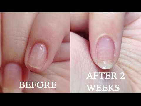 How To: Grow Your Nails in Just TWO WEEKS!! - YouTube - How Much Do Nails Grow In 2 Weeks