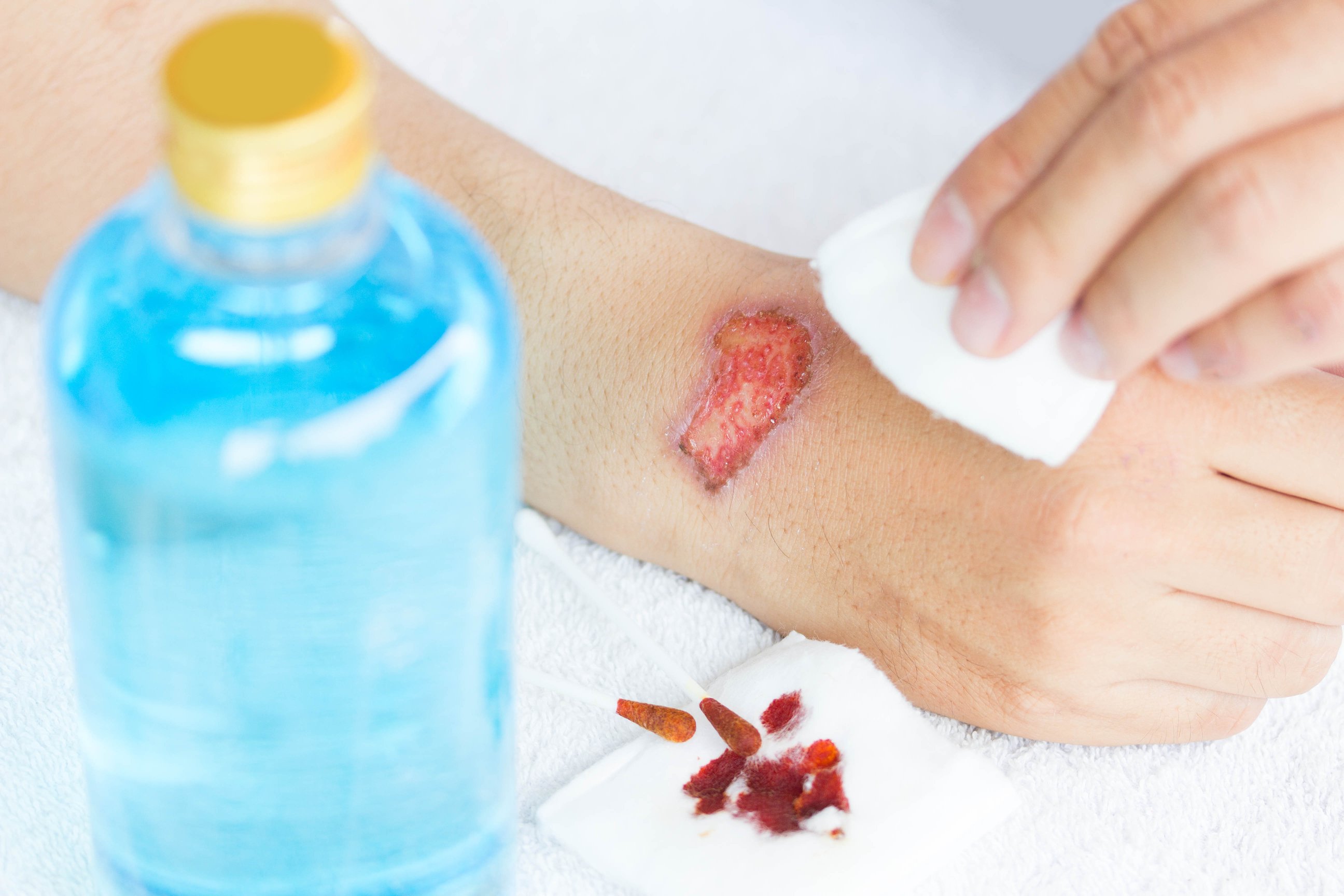 Wound Closure Medical Devices Product Pipeline Market