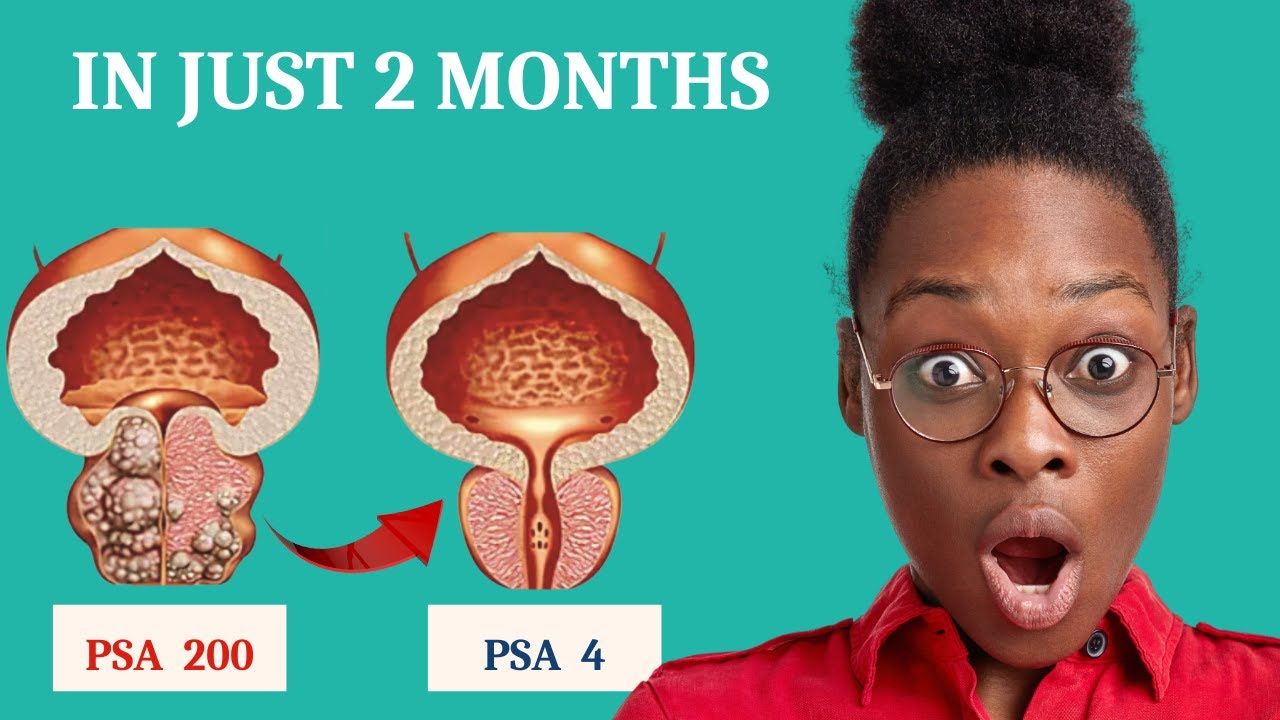 HOW TO LOWER YOUR PSA LEVELS NATURALLY - YouTube - How To Lower Psa Levels Quickly