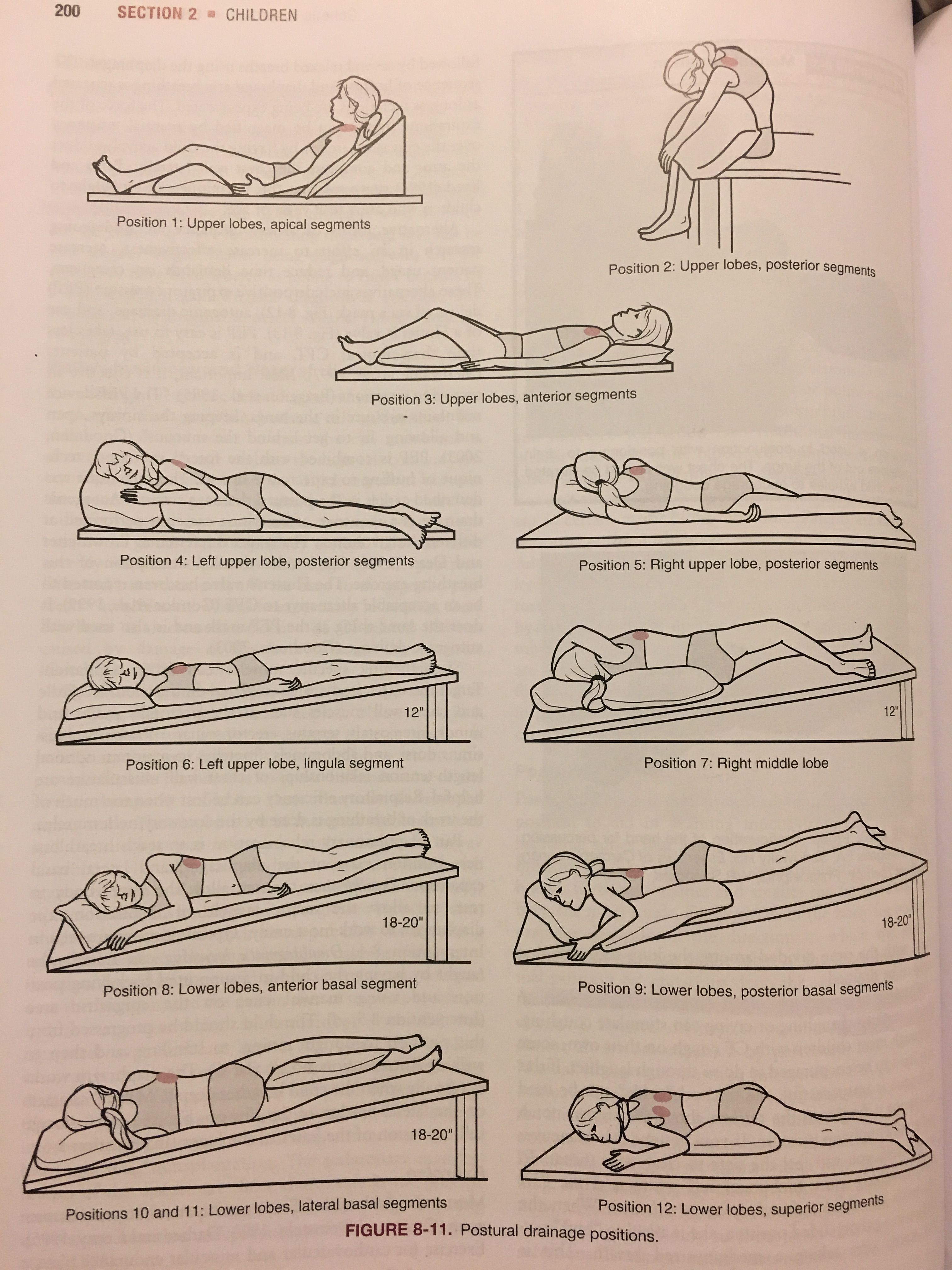 How To Remember Postural Drainage Positions at George Redden blog - How To Remember Postural Drainage Positions