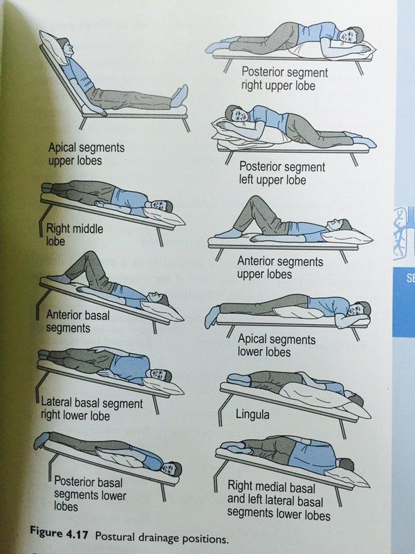 How To Remember Postural Drainage Positions at George Redden blog - How To Remember Postural Drainage Positions