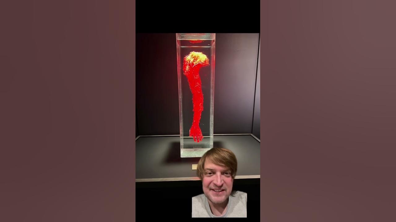 Why Did The Bodies Exhibit In Atlanta Close Today
