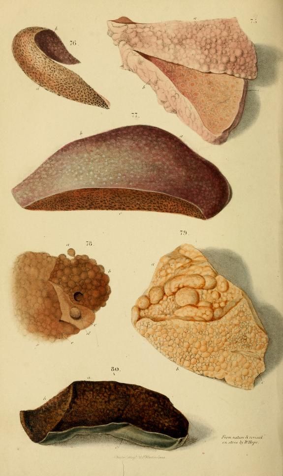 Substance Created By Mold That Damages The Liver