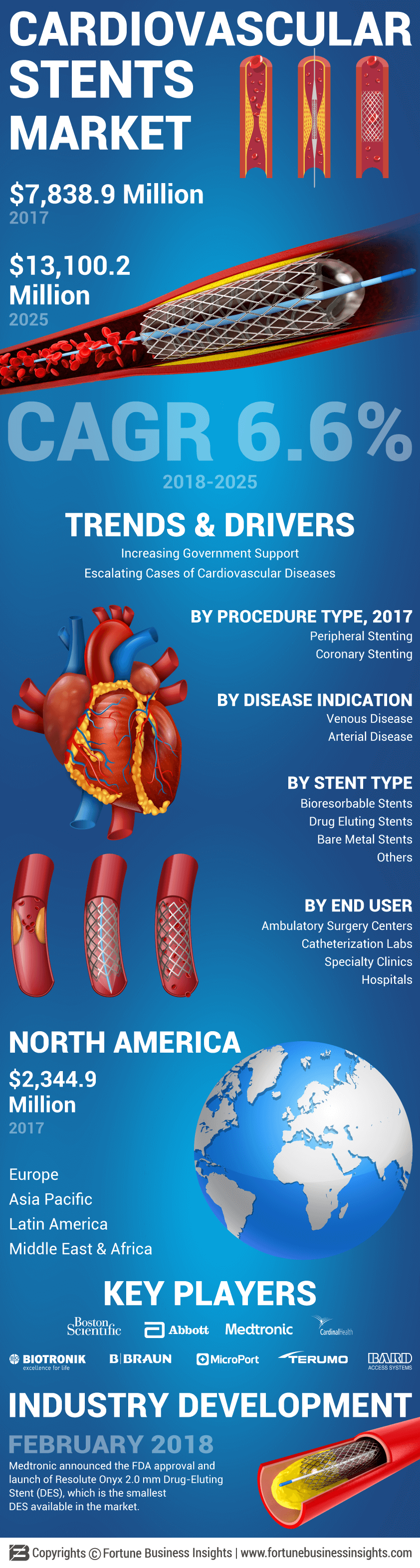 Infographics - Cardiovascular Stents Market - Aortic Stent Grafts Pipeline Products Market