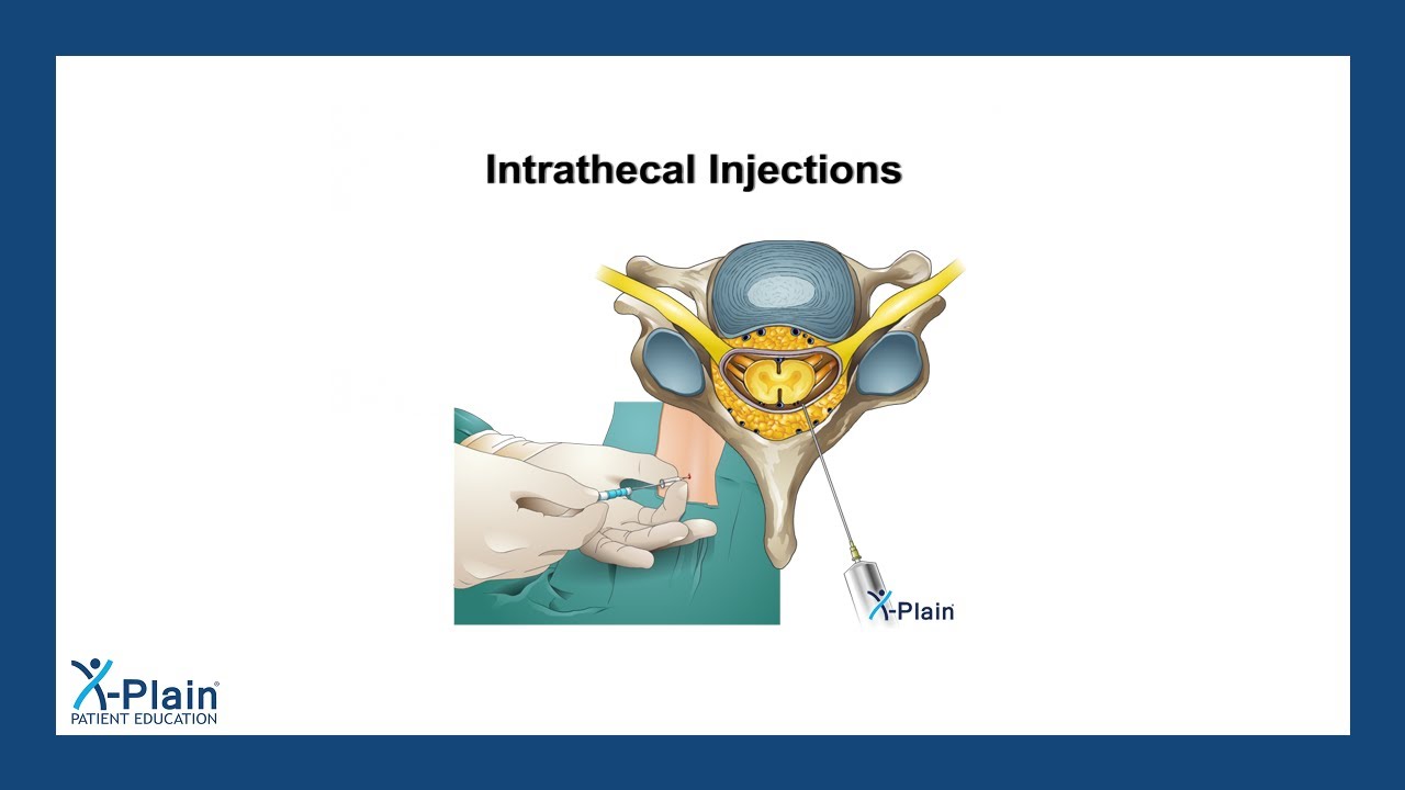 Intrathecal Injections - YouTube - Intrathecal Injection Is Administered Into The