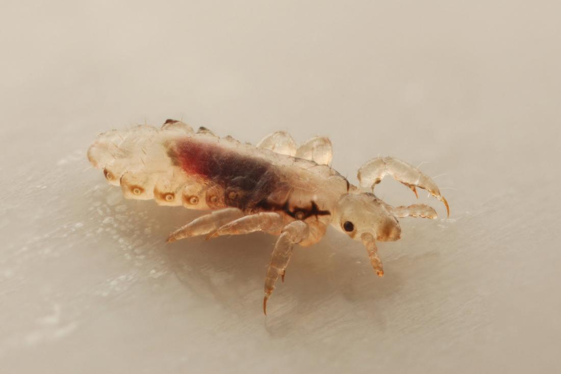 Is it lice? Know the symptoms - Lice Clinics Of America - Dublin & Columbus
