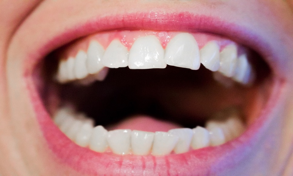 Looking for Overall Health? Take Care of Your Oral Health: A World Oral - Oral Antibiotics For Gram Negative Bacteria