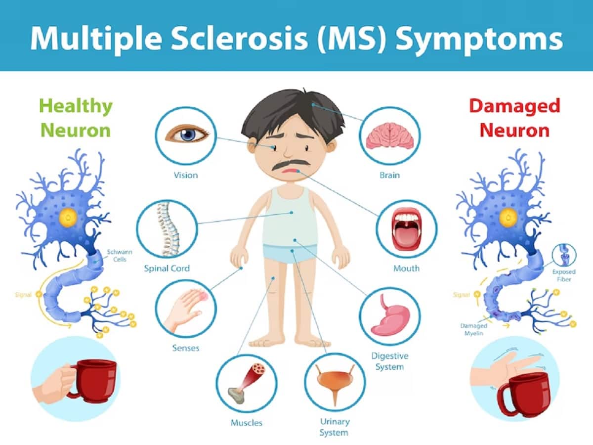 Ms Center For Innovations In Care
