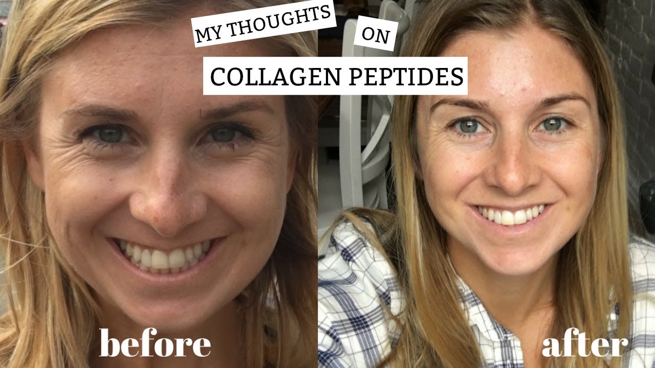 My Thoughts on Collagen Peptides + Benefits | Plus My Before and After - Nativepath Bone Health Collagen Peptides Reviews