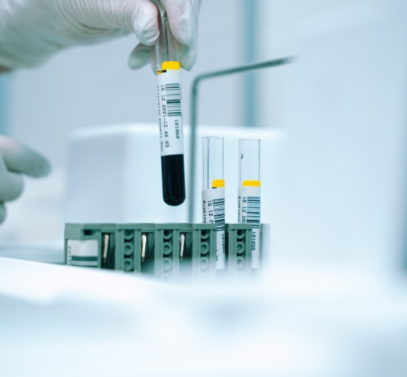 NaraTechLab - Any Lab Test Now South Jordan