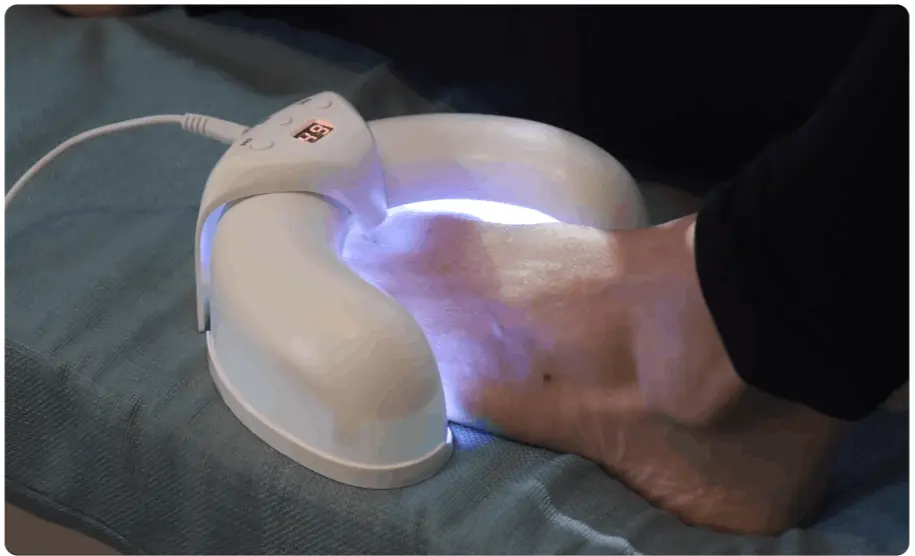 Okita Nail Fungus Light® | OFFICIAL SITE - Okita Nail Fungus Light Reviews Consumer Reports