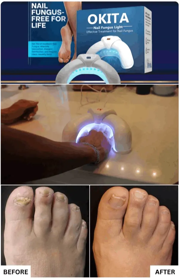 Okita Nail Fungus Light® | OFFICIAL SITE - Okita Nail Fungus Light Antifungal Device